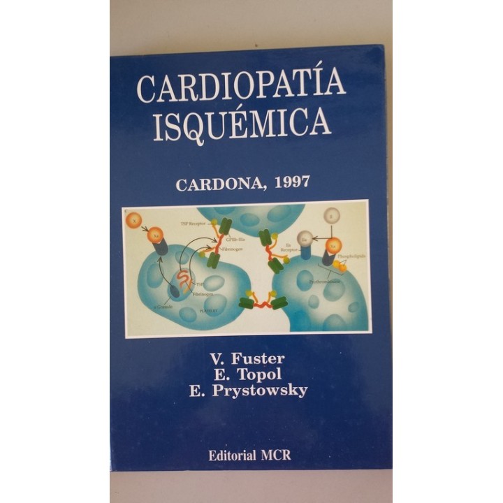 Cardiopatía Isquémica
